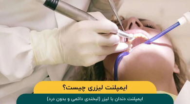 ایمپلنت دندان با لیزر